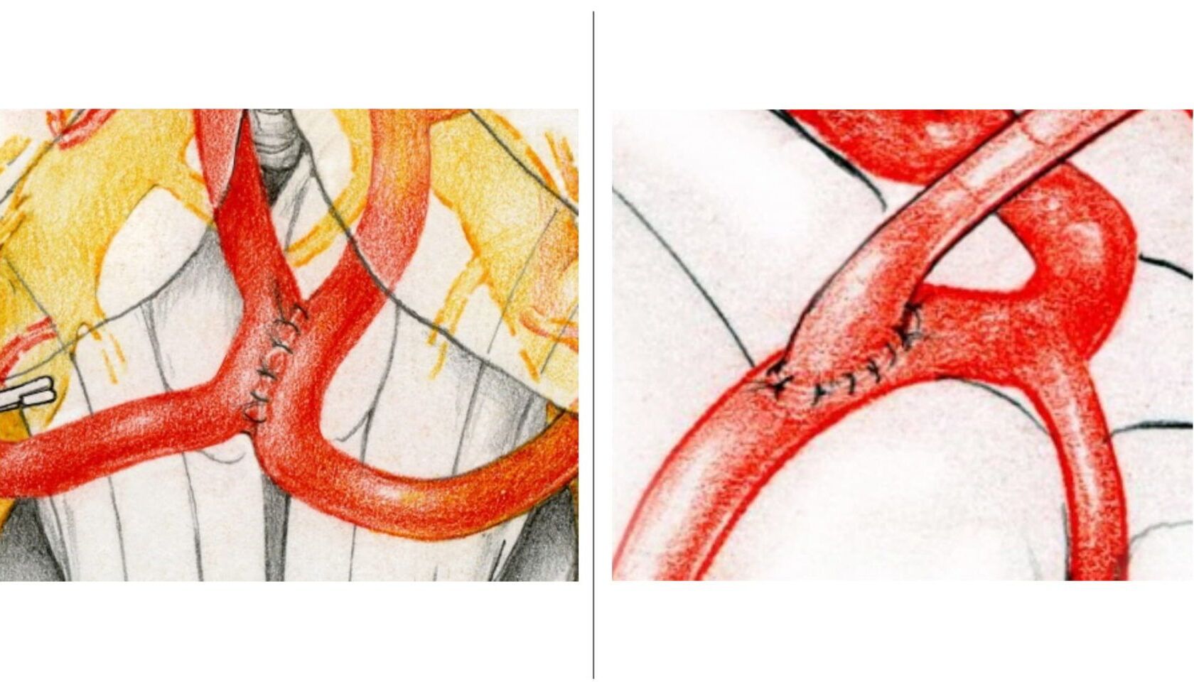 Lire la suite à propos de l’article Cours de microchirurgie de Zurich / Eté